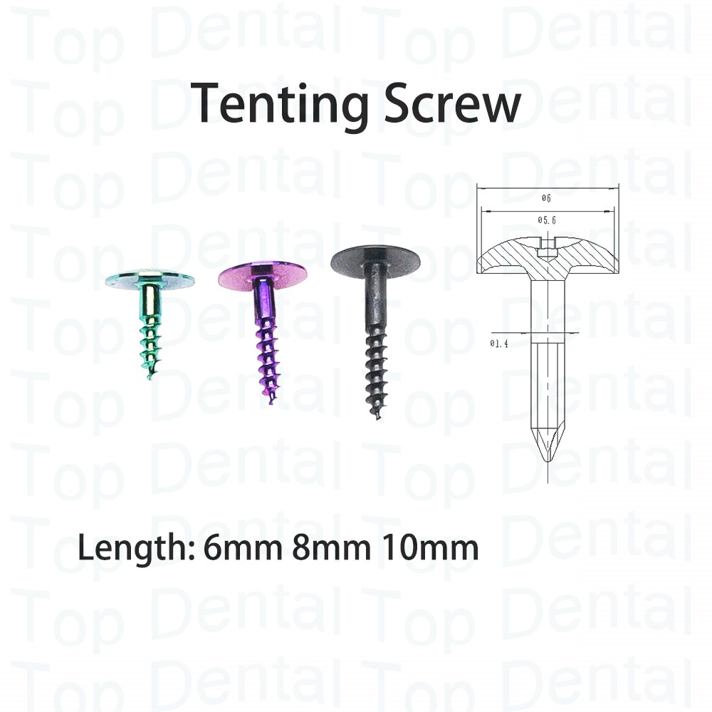 10 pz Dentale Sistema GBR Viti - Stabilizer Screw In recensione e prezzo