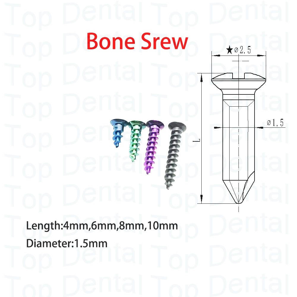 10 pz Dentale Sistema GBR Viti - Stabilizer Screw In recensione e prezzo